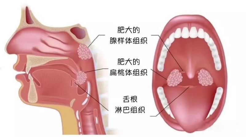 【我为群众办实事】耳鼻咽喉头颈外科免费检查来啦~~~